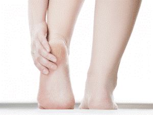 Plantar Fasciitis: An Overview